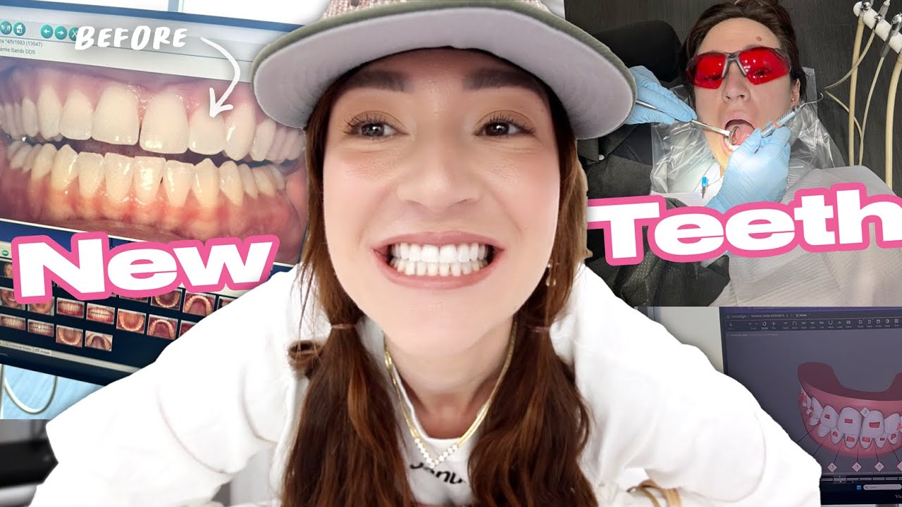Finally Showing You My New Teeth!!!