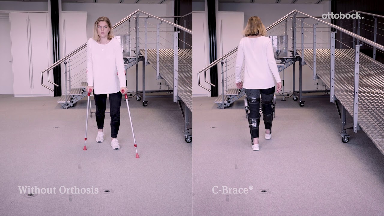 Rebecca C-Brace Gait Comparison Video | Ottobock