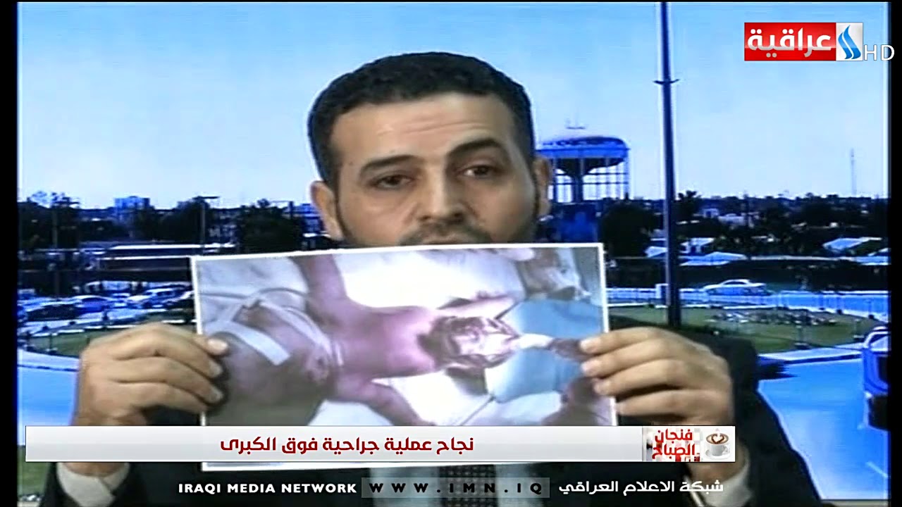 فنجان الصباح - لقاء مع د. عمر عبد القادر / اخصائي جراحة الاطفال - مستشفى الرمادي