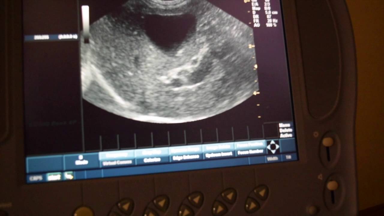 Ultrasound of Cats Abdomen