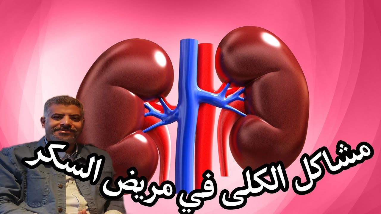 kidney and diabetes?  مشاكل الكلى في مريض السكر (محاضرة طبية)
