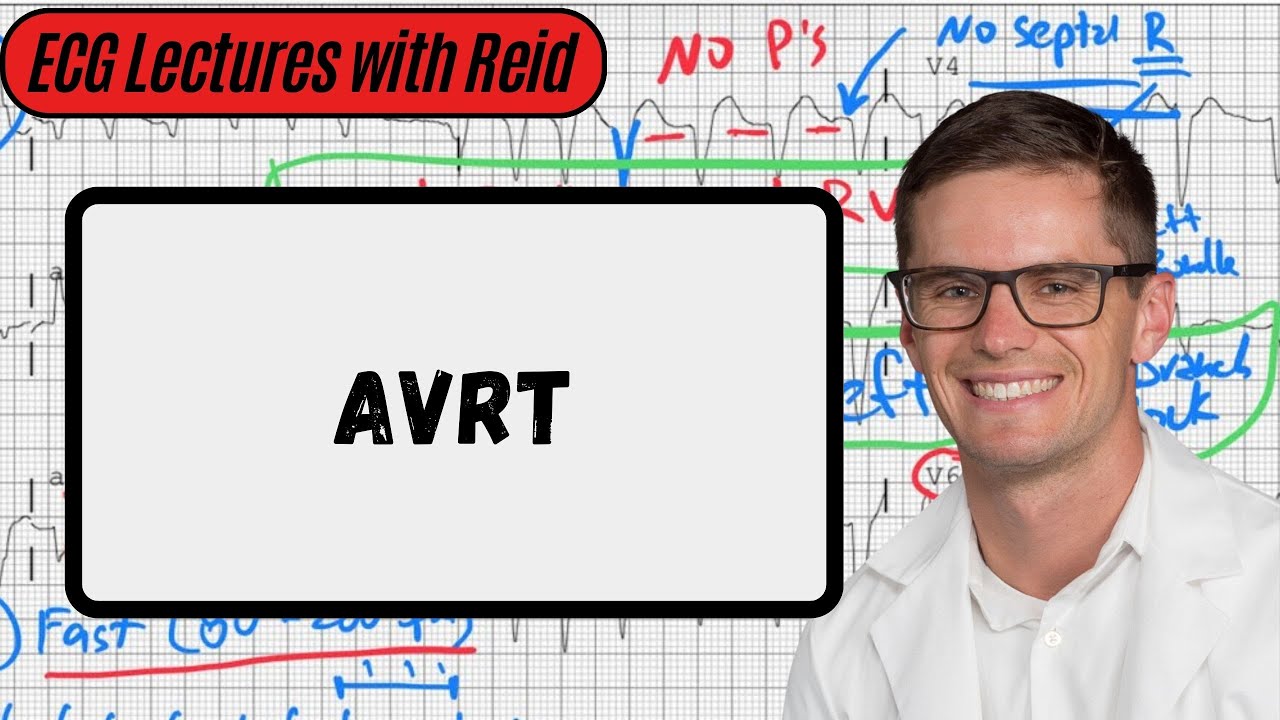 AV Reentry Tachycardia | Day 18 ECG Challenge