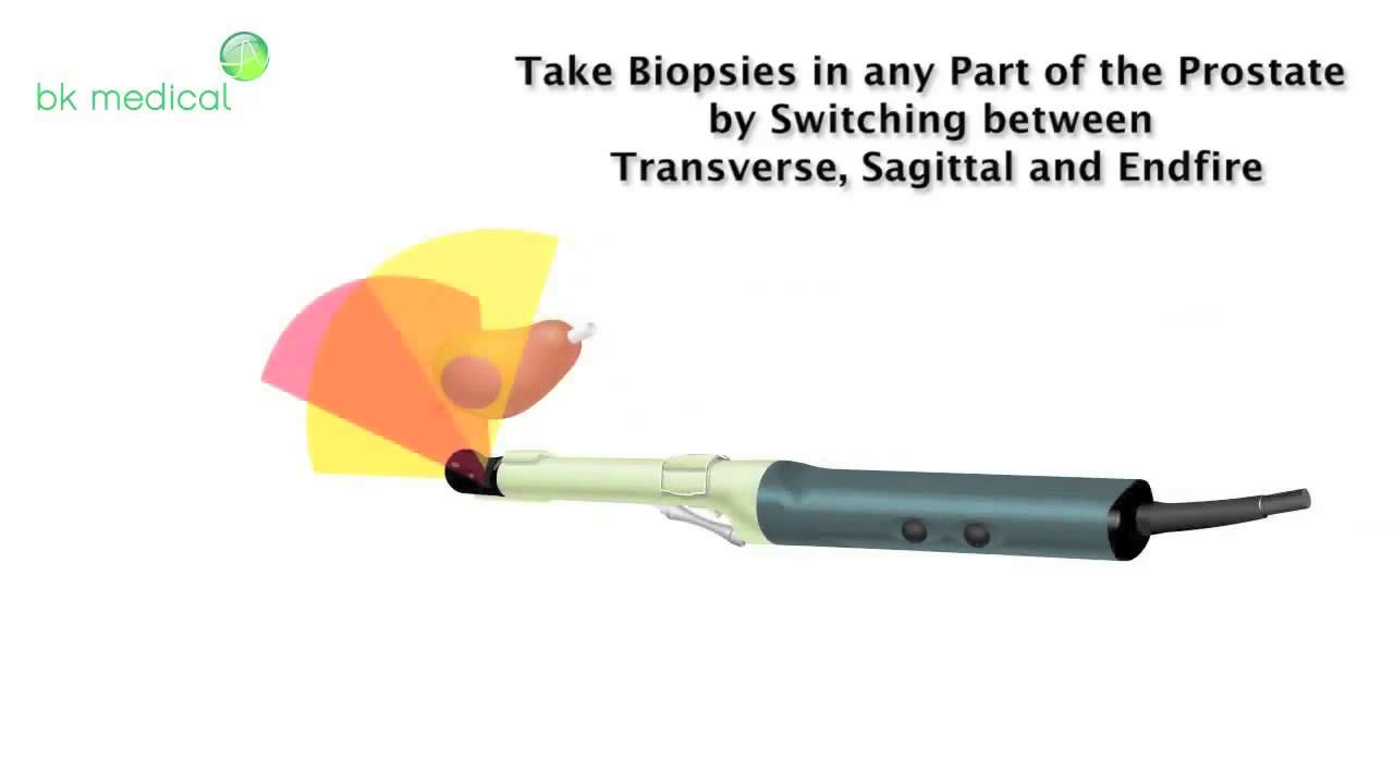 Image all prostate zones with the Triplane Transducer