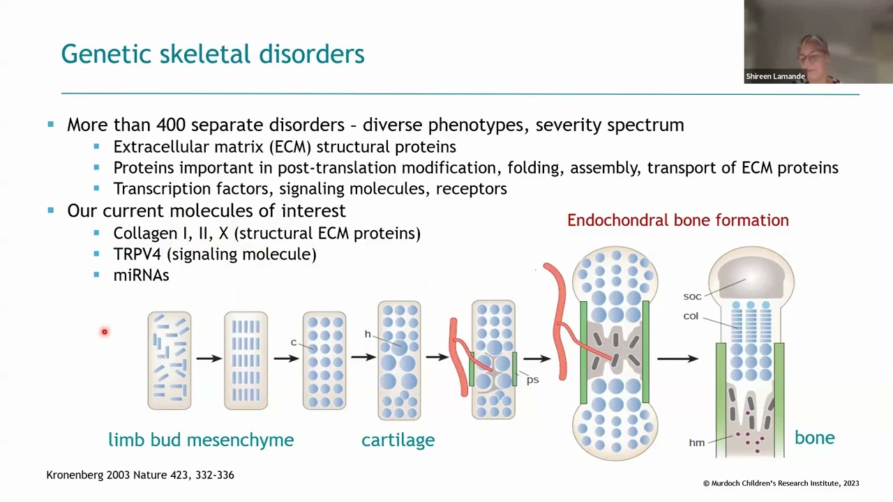 Stem Cells & Arthritis