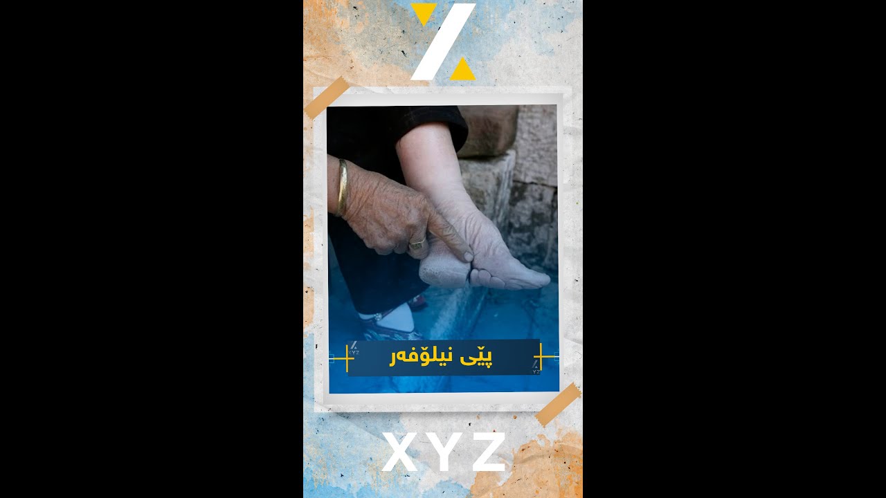 پێی نیلۆفەر، یەکێک لە پێوەرەکانی جوانی لە وڵاتی چین