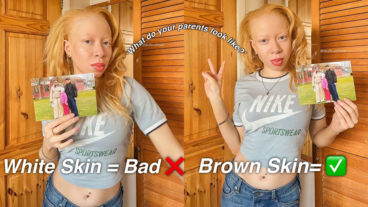 I Was Jealous Of My Parents’ Skin Tone (s)