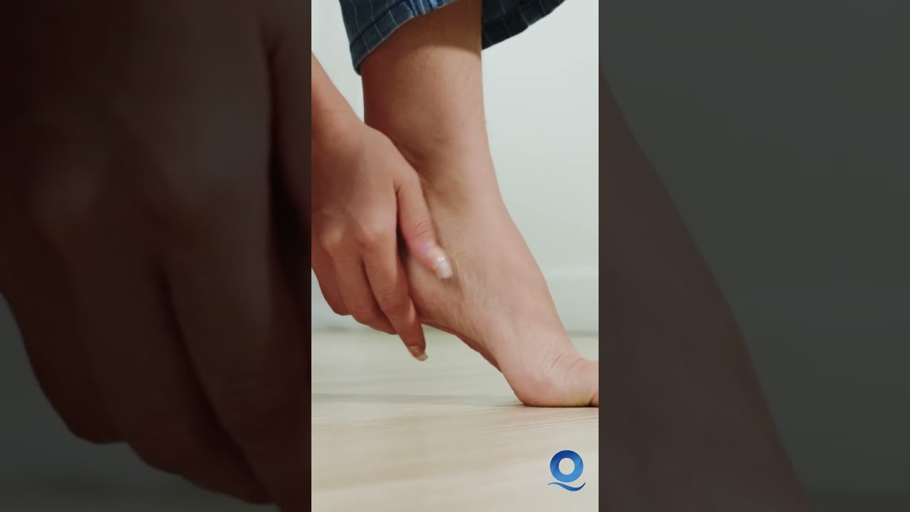 Fascite Plantar | Inflama&ccedil;&atilde;o, aliviar a dor e habilitar para as atividades di&aacute;rias