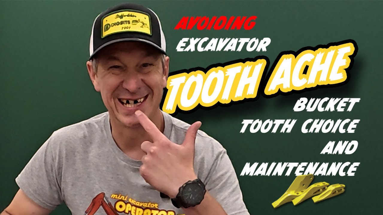Avoiding Excavator Tooth Ache! | Bucket Teeth Explained