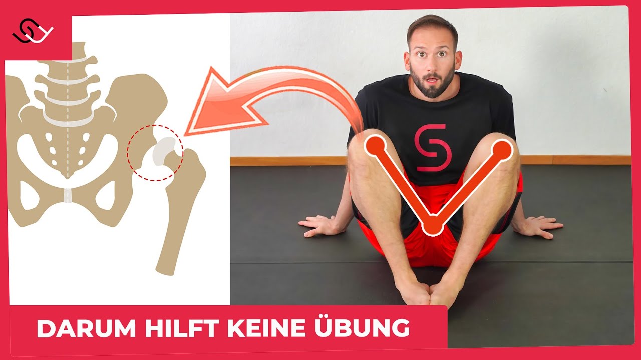 DESWEGEN wird deine Hüfte nie beweglich!