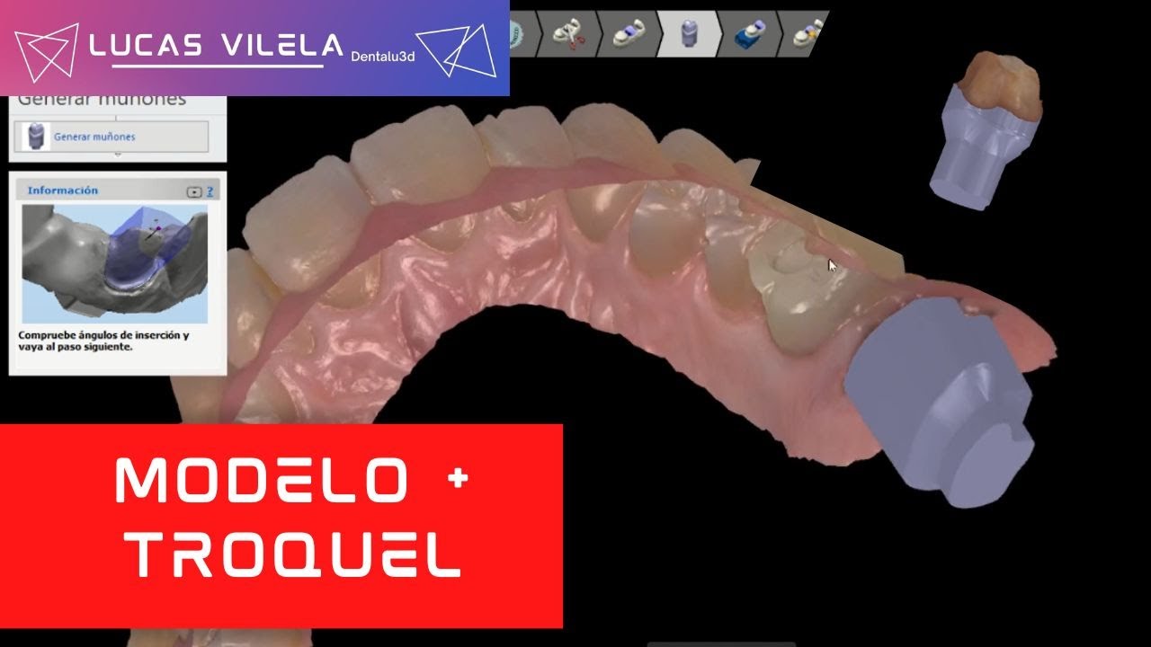 MODELO + TROQUEL / 3SHAPE