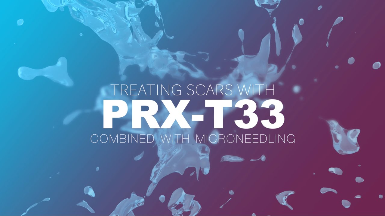 Treating Scars Combined With Microneedling | V. Shavlak – PRX-T33 Training Sessions – PART 2