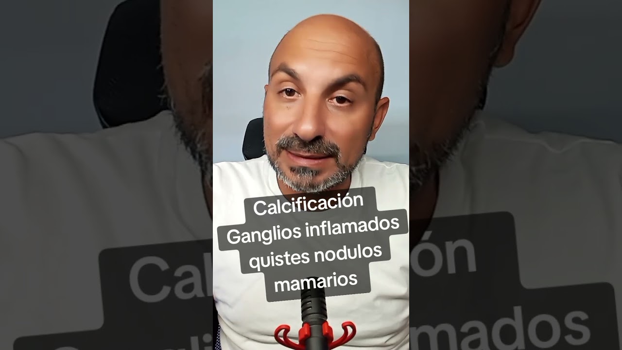 Calcificaciónes Ganglios inflamados Nódulos y quistes mamarios 