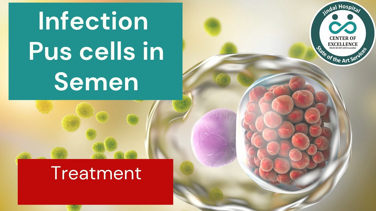 Infection in semen