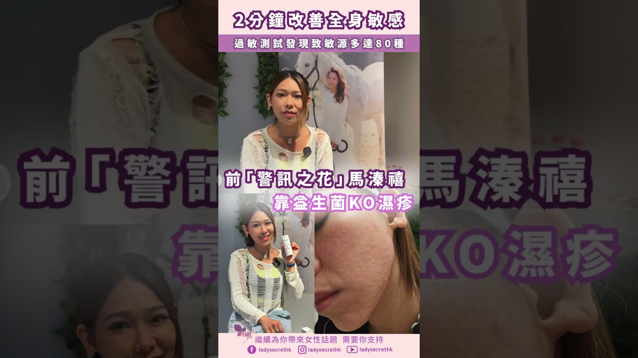 2分鐘改善全身敏感前「警訊之花」馬溱禧靠益生菌KO濕疹