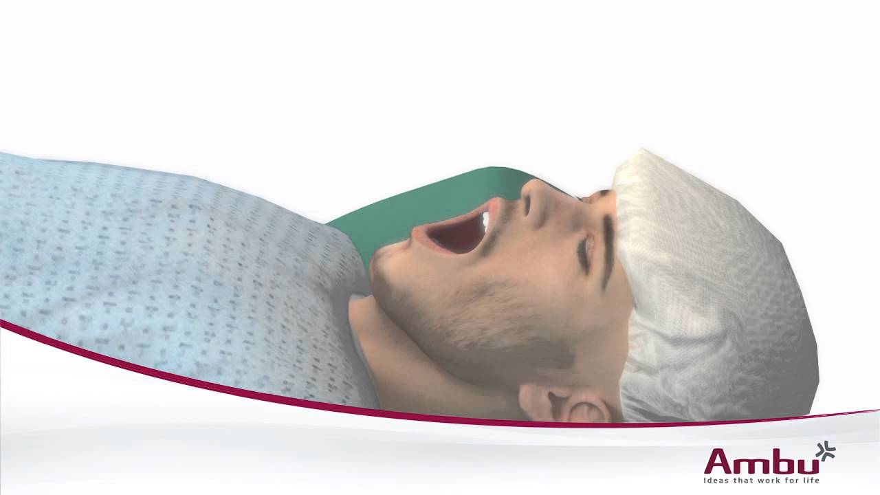 Ambu® aScope™ 3 and Ambu® Aura-i 3D animation