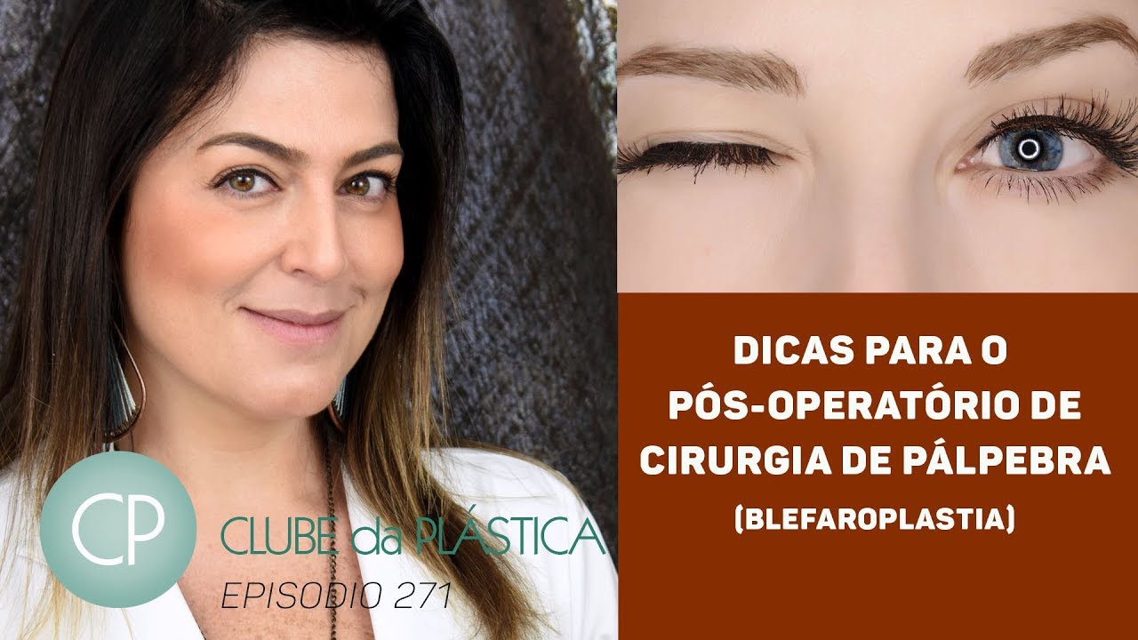 Clube da Plástica: Dicas para o pós-operatório de cirurgia de pálpebras (blefaroplastia)