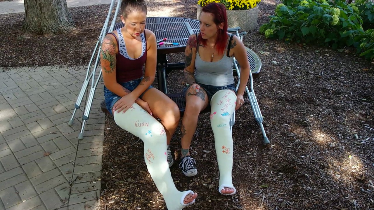 What can you put in a cast?