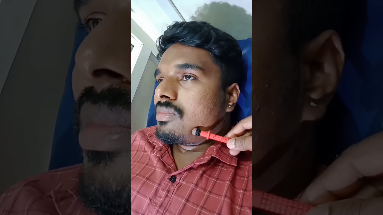 physiotherapy for Bell's palsy