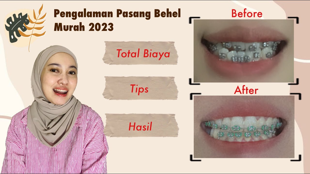 PASANG BEHEL METAL MURAH | TOTAL BIAYA 2023 | HASIL