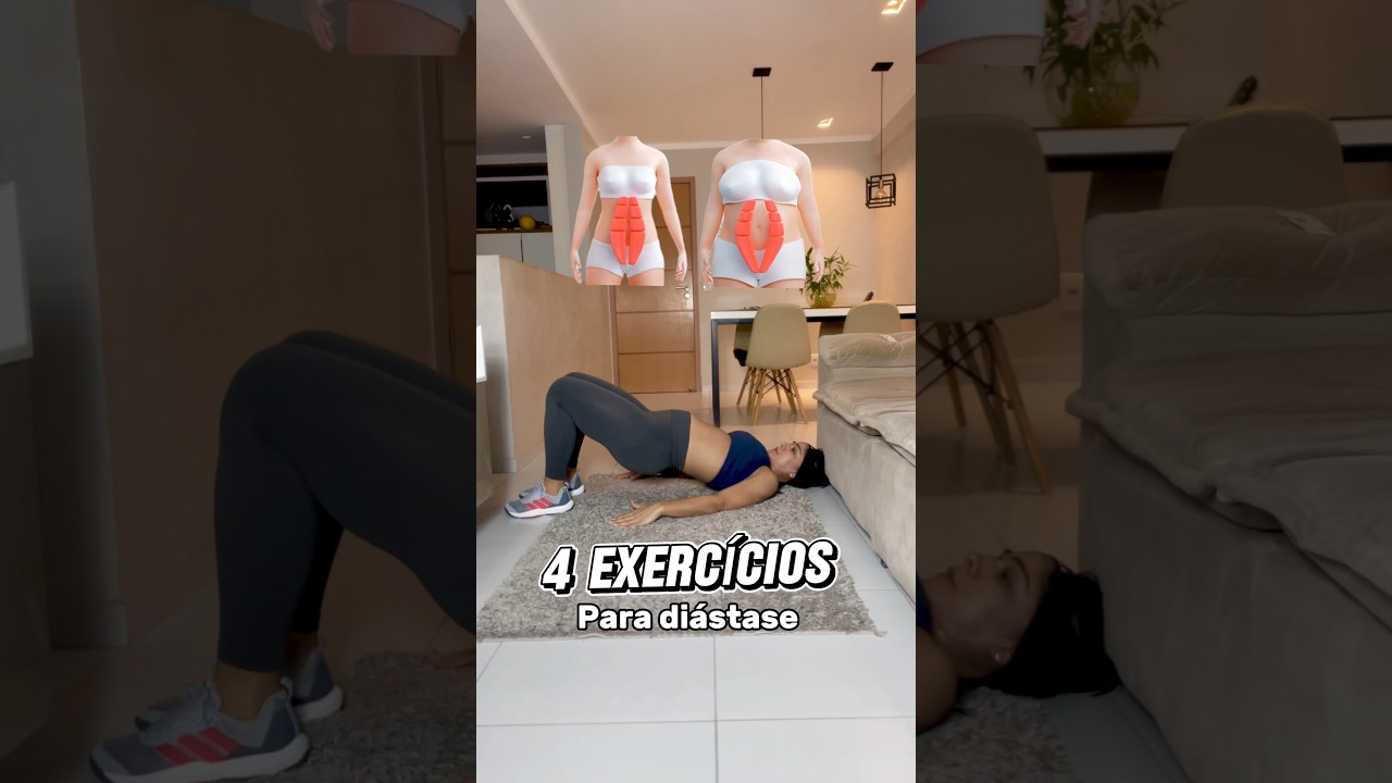 4 exerc&iacute;cios para Di&aacute;stase abdominal
