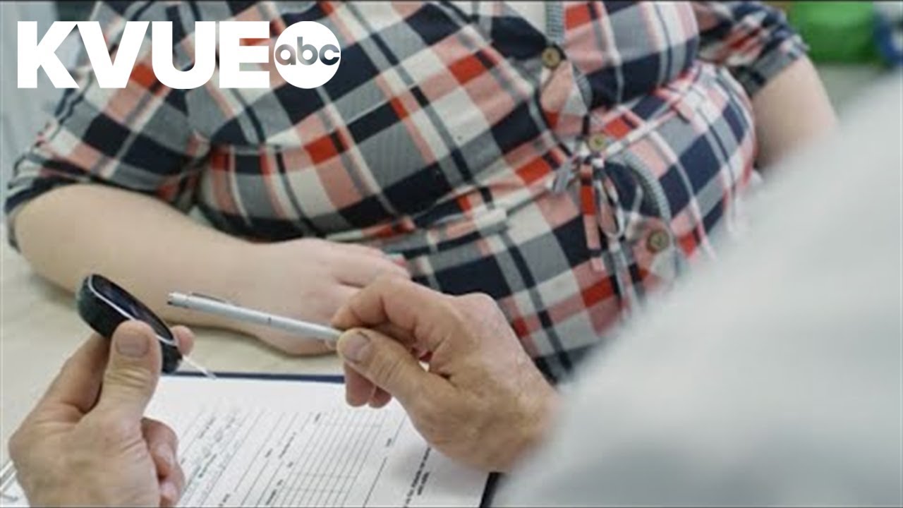Over 1 in 3 U.S. adults is impacted by obesity, CDC says