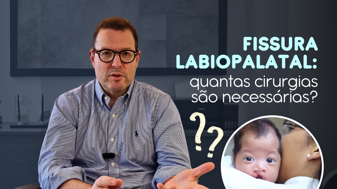 Quantas cirurgias um bebê precisa para tratar fissura labiopalatal