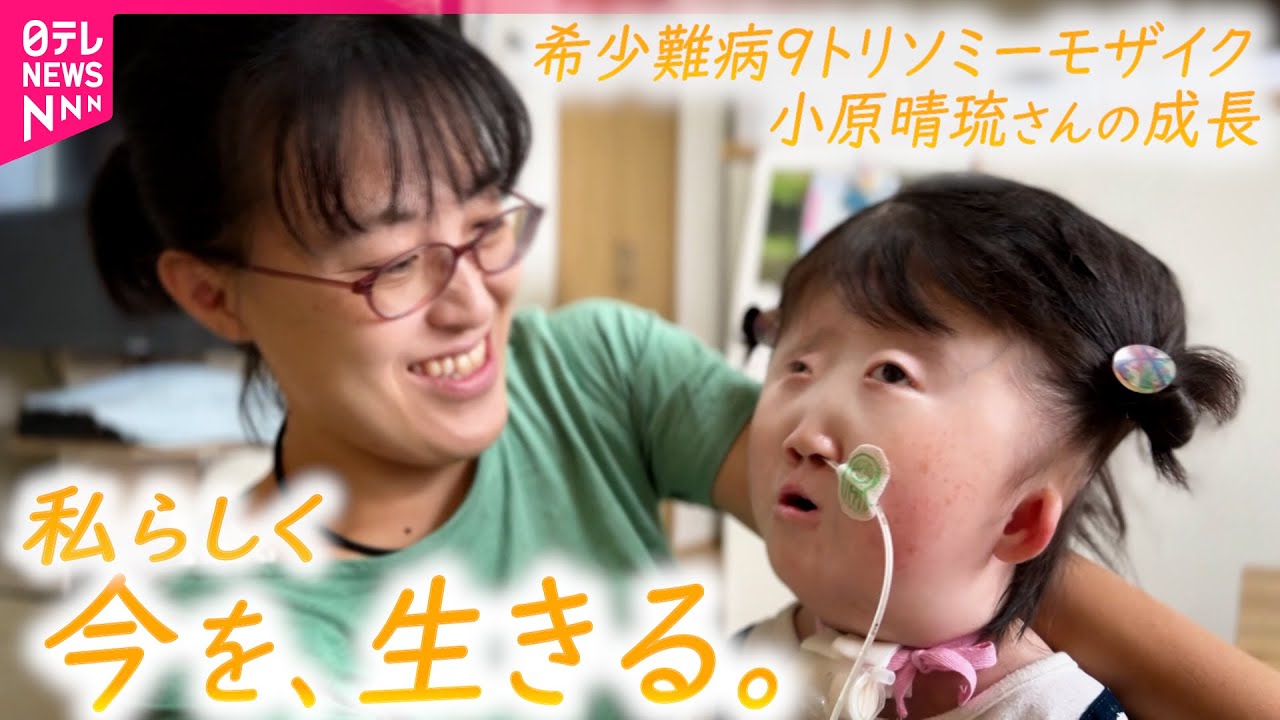 【密着】世界で50人の希少難病 