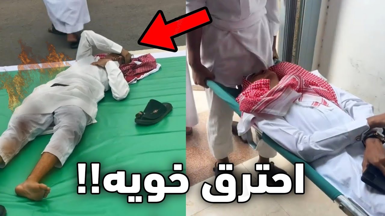 الولد هذا احترق داخل الغرفه!