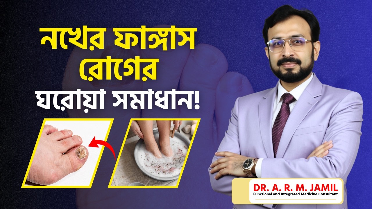নখের ফাঙ্গাল ইনফেকশন দূর করার সেরা ঘরোয়া উপায়! দ্রুত সমাধান ও প্রতিরোধ ব্যবস্থা | Toenail Fungus