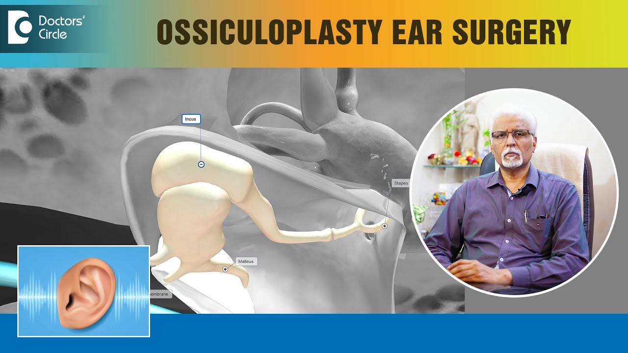 Hearing Loss Treatment - OSSICULOPLASTY Ear Surgery Procedure- Dr.Harihara Murthy | Doctors' Circle