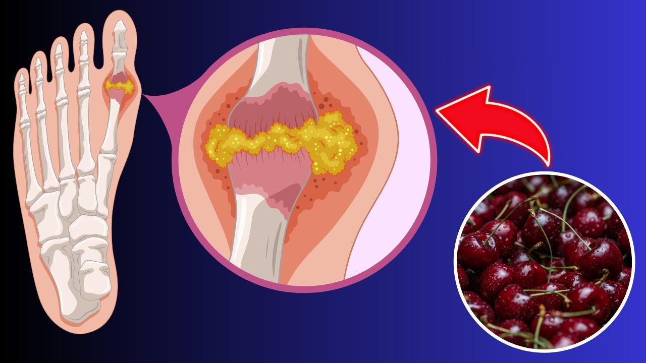 10 Reasons to Drink Tart Cherry Juice Daily | Tart Cherry Juice Benefits