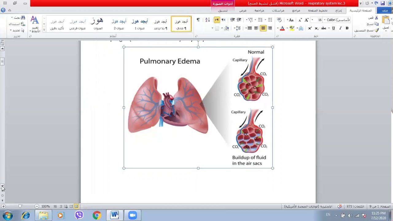 Pathology of Respiratory system. Part 3 / د. رشا الجوهر