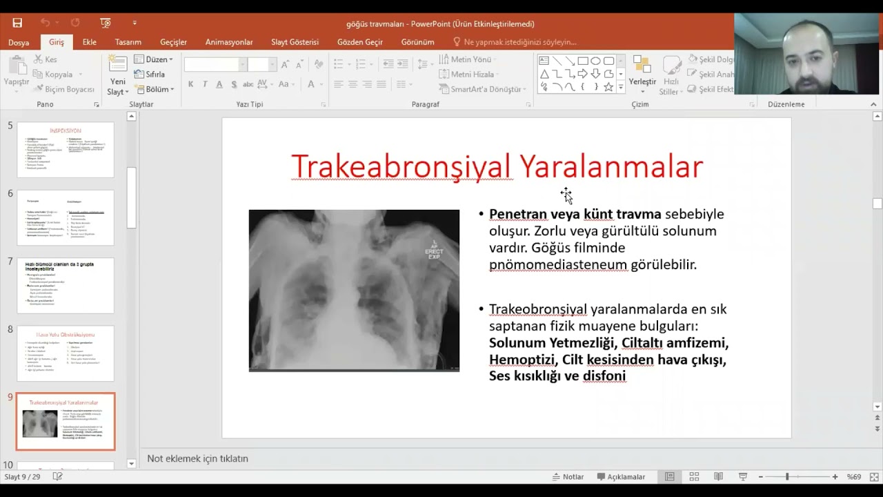 Acil Serviste Toraks Travmalarına Yaklaşım