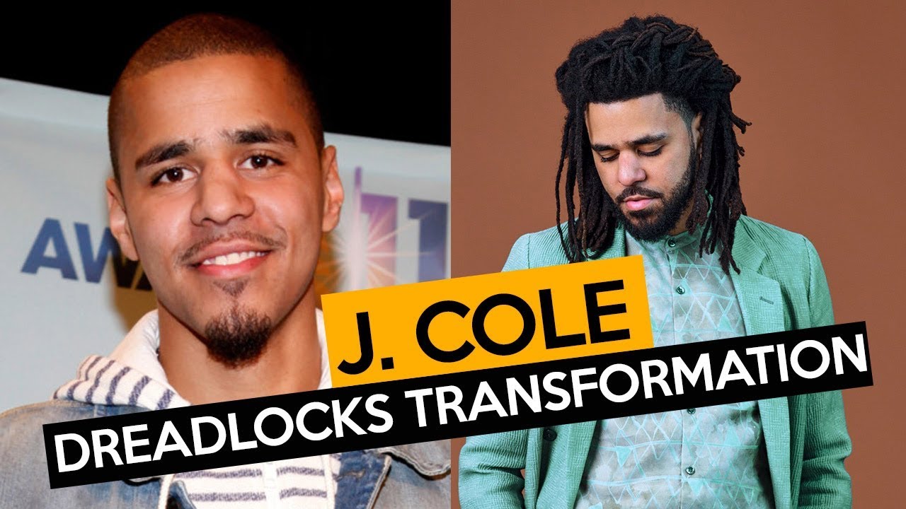 J. Cole FREEFORM Dreadlocks Transformation