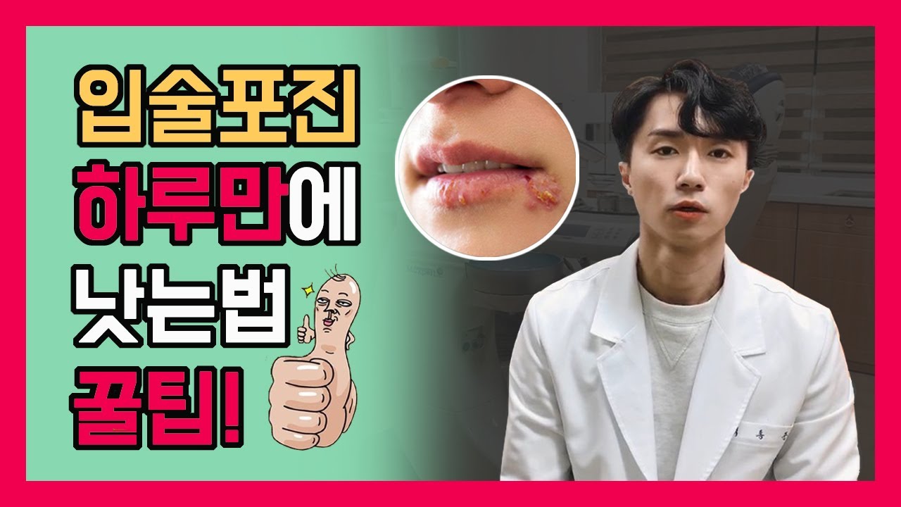 치과의약사가 알려주는 헤르페스 입술포진 빨리 낫는법과 원인~이렇게해보세요  (feat 아시클로버, 발라시클로버)