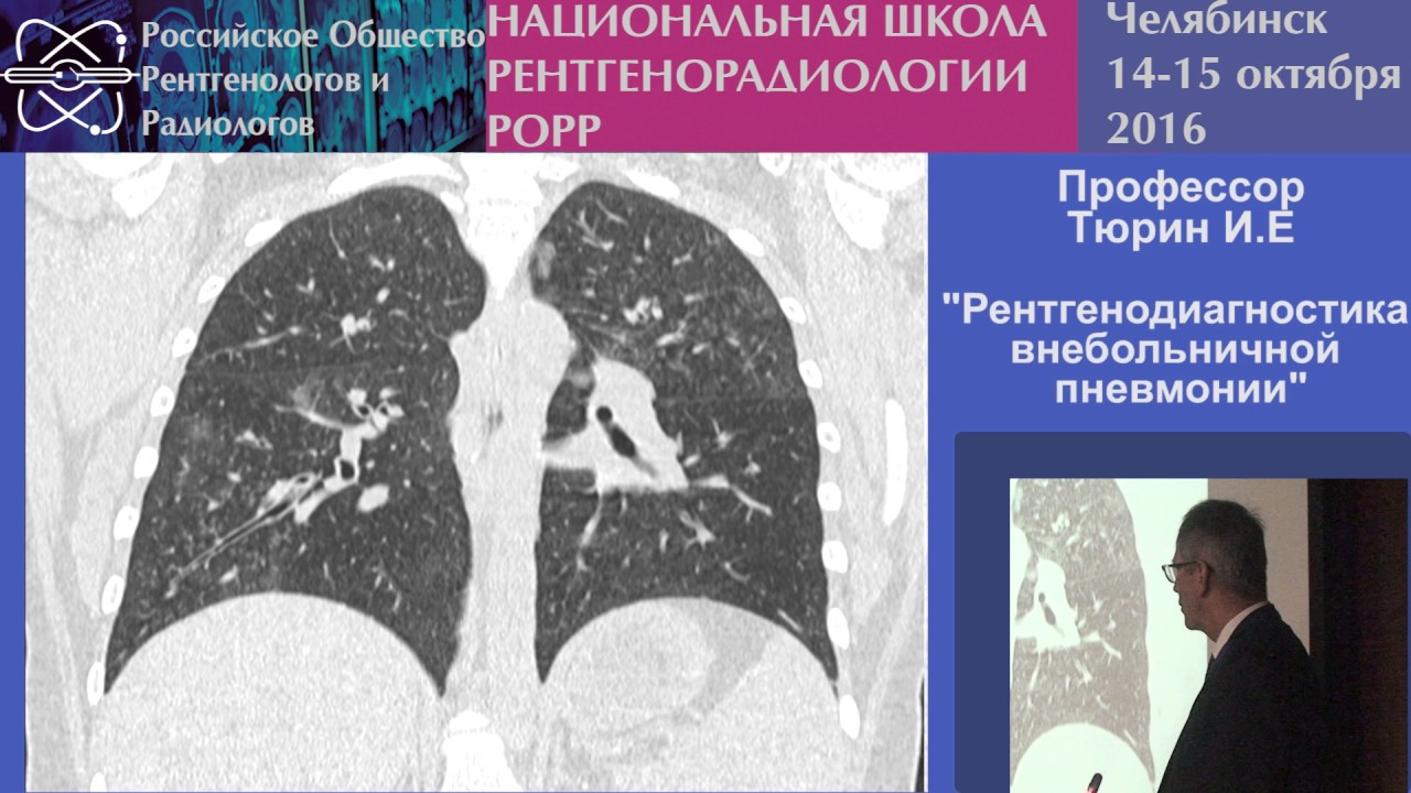 И.Е. Тюрин - Рентгенодиагностика внебольничной пневмонии