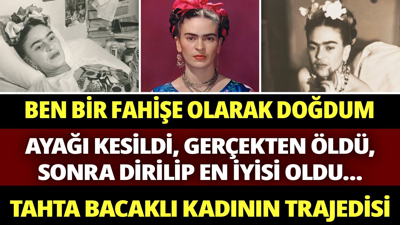 FRIDA KAHLO ve Dramı: Tahta Bacaklı Kadının Karanlık Gerçekleri ve Delilik İçinde Korkunç Bir Yaşam.