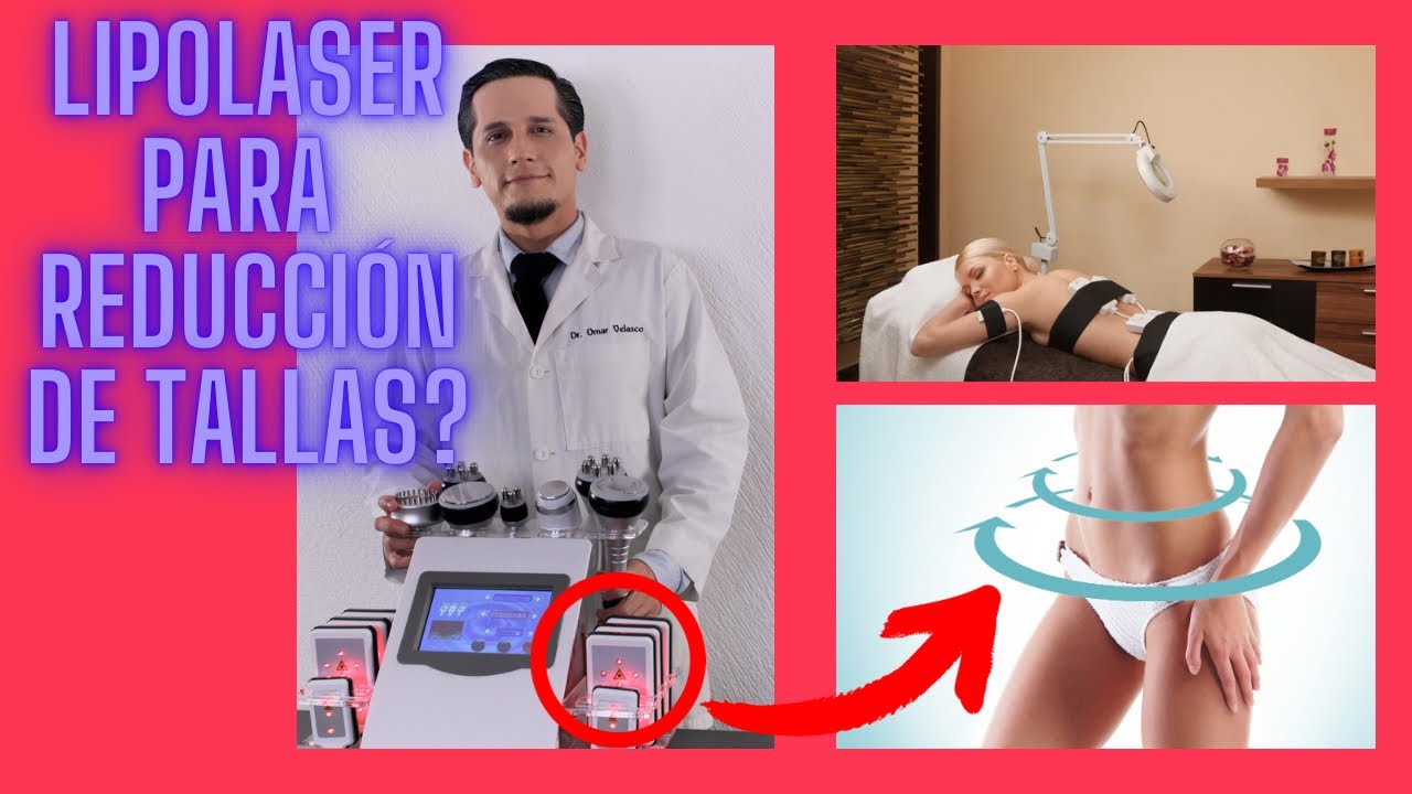Que es EL LIPOLÁSER? Y como ELIMINA LA GRASA?