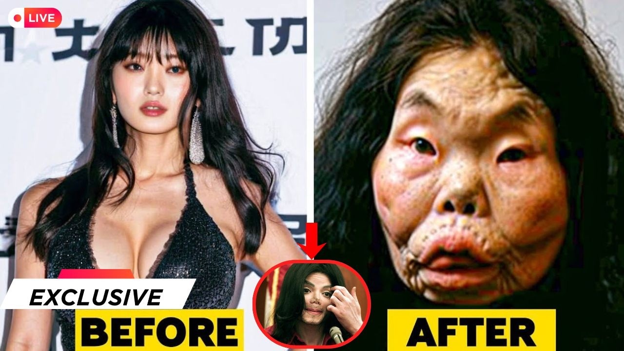 20 Celebrities With the Most Controversial Plastic Surgery Transformations