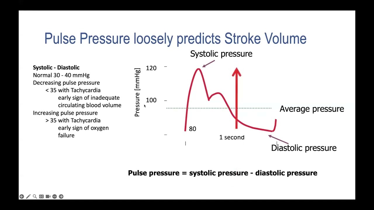Hemodynamics: All about Perfusion