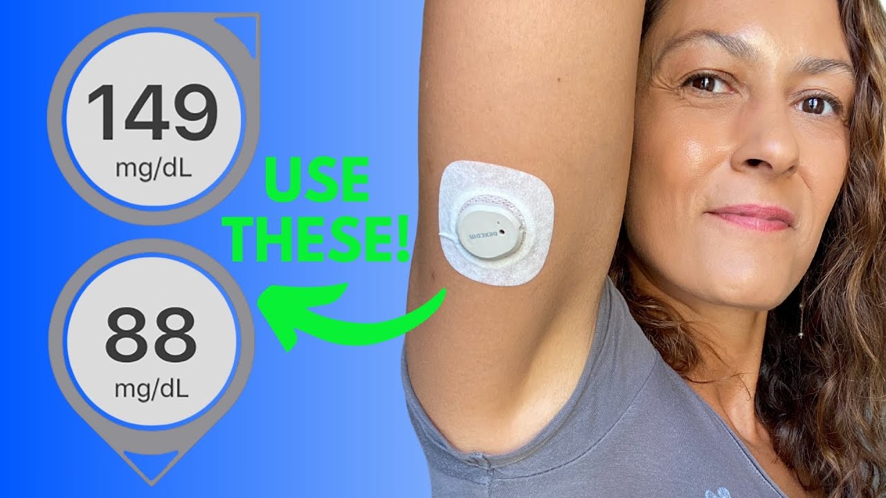 Use the Dexcom Trend Arrows to Lower Your Blood Sugars