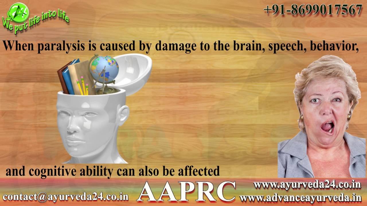 Natural Methods to Cure Paralysis | Ayurvedic Home Remedies for Paralysis | Advance Ayurveda