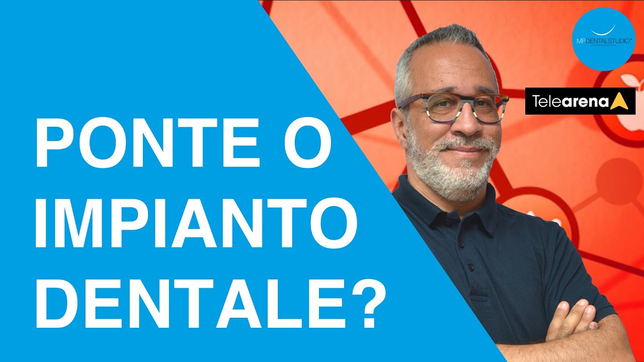 Meglio un ponte o un impianto dentale? - Prof. Makarati a Dica33 - Telearena