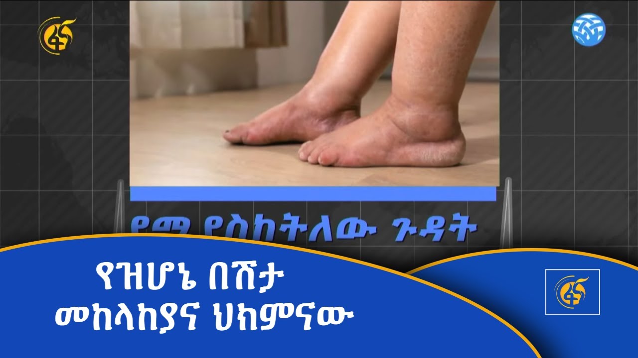 የዝሆኔ በሽታ መከላከያና ህክምናው
