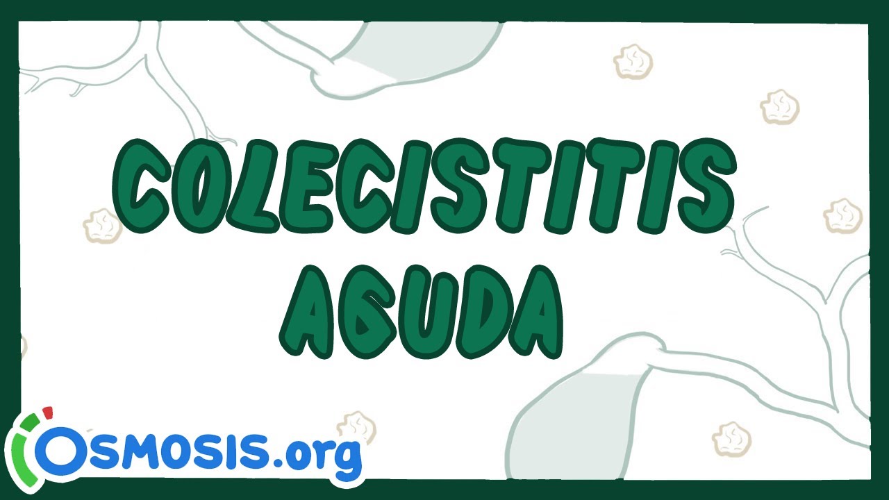 Colecistitis Aguda - Ósmosis en Español