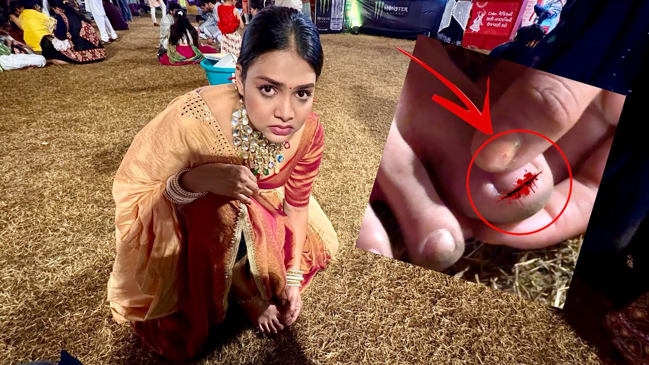 She Got Badly Hurt in Garba | Nail Broken | She Cried