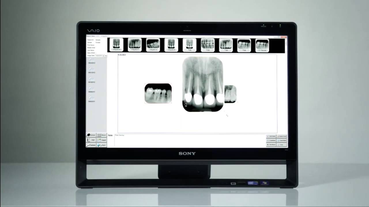 Apixia Digirex Phosphor Plate (PSP) X-Ray Scanner