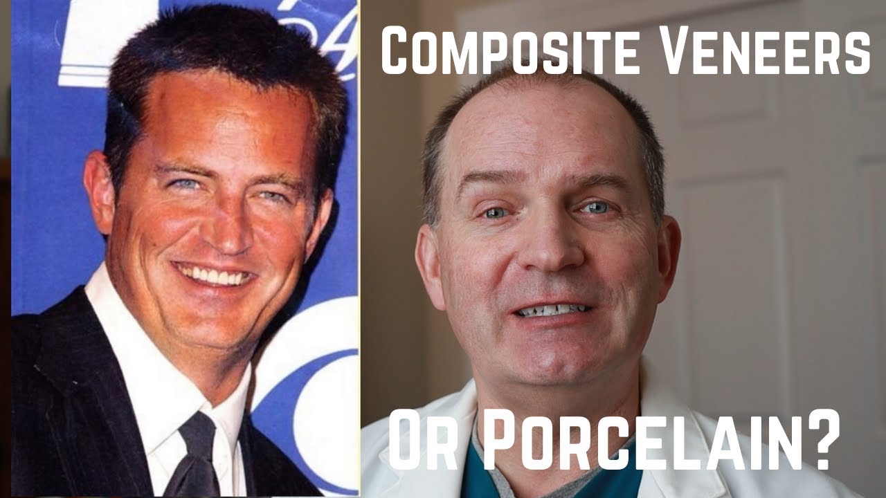 What's better composite veneers or porcelain veneers?
