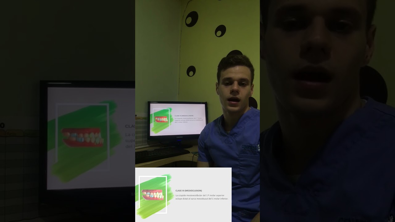 Aparatologia de Simoes Network 1/3