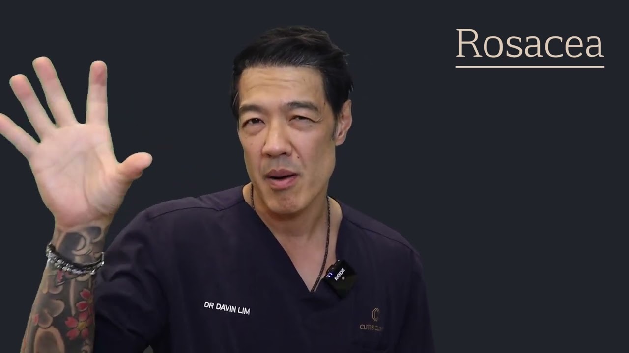 Rosacea Laser Treatments | Cutis Dermatology